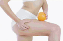 cellulite e ritenzione